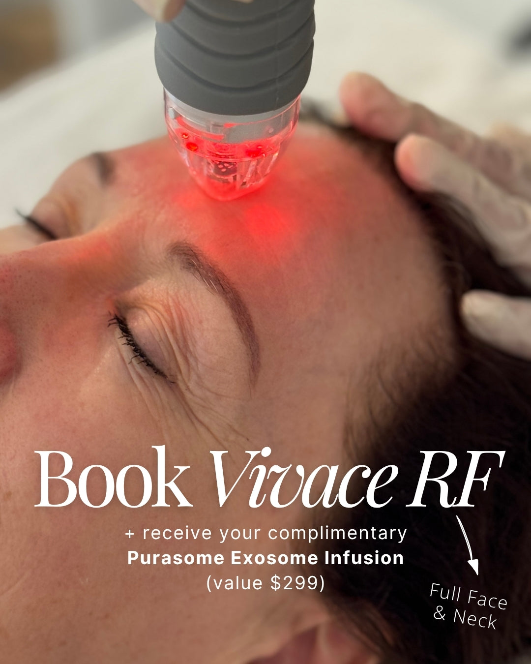 Vivace Winter Skin Renewal Package