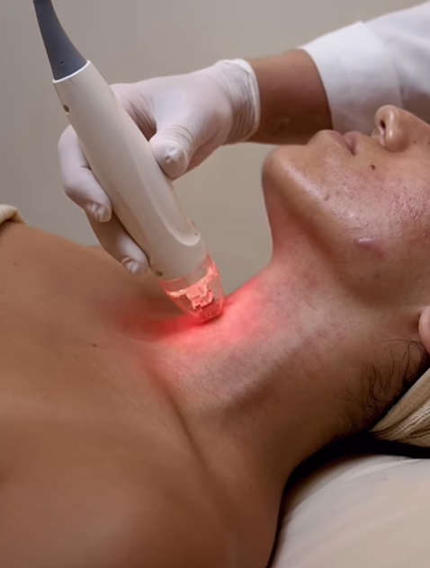 Vivace Winter Skin Renewal Package