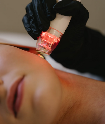 Vivace Winter Skin Renewal Package